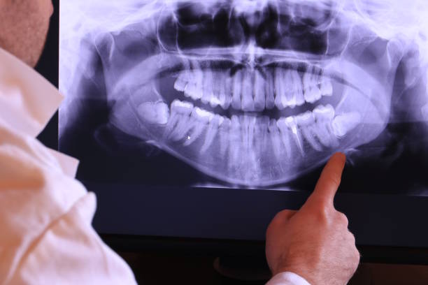 Best Emergency Denture Repair in South Hill, NY
